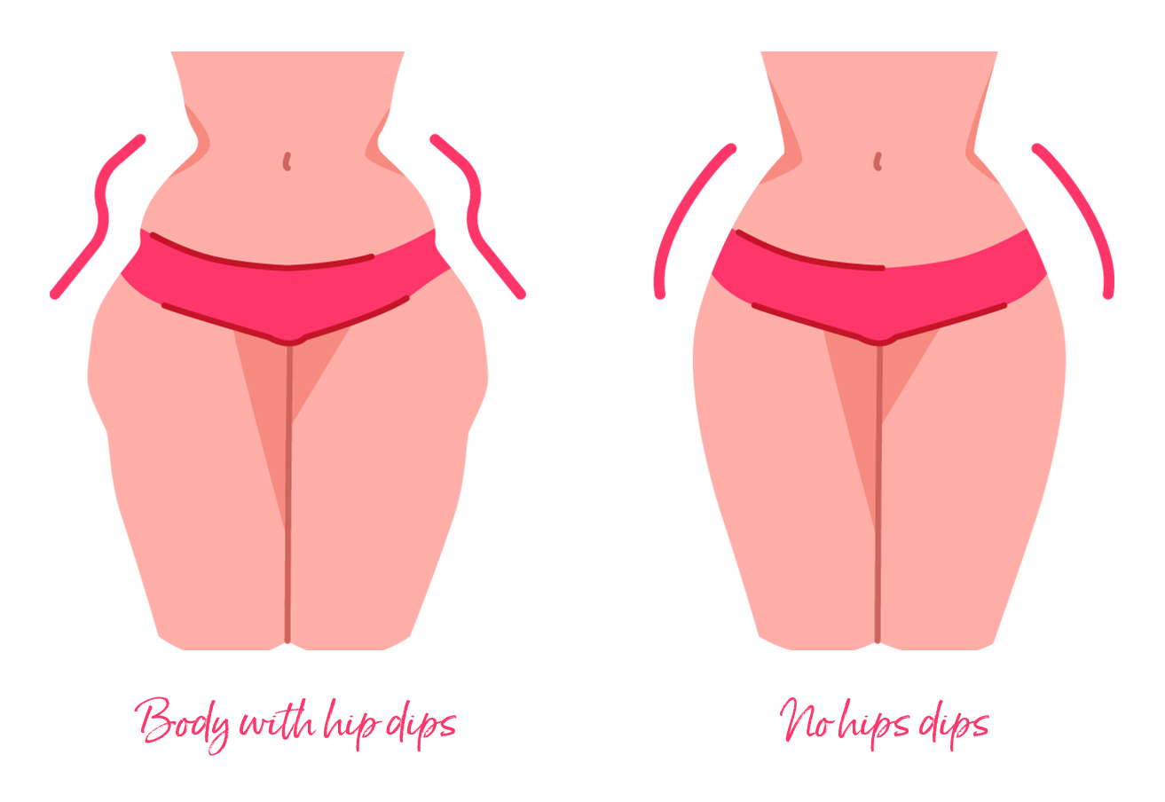Hip Dips: Are Hip Dips Normal? How Do I Have More Rounded Hips 