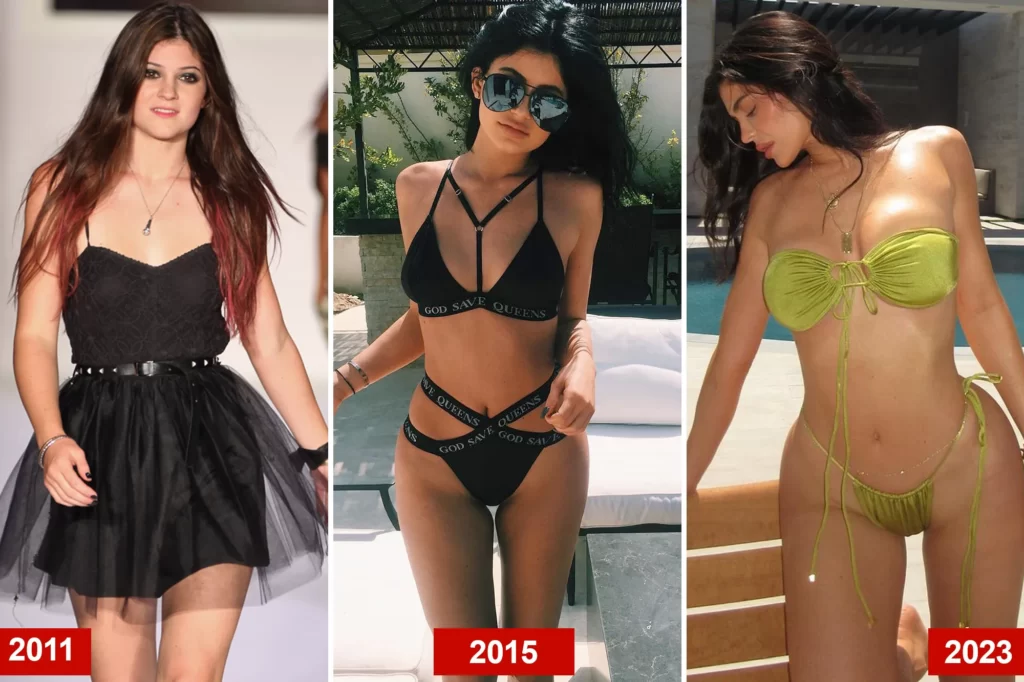 Check Out Kylie Jenner Before And After Body Transformation Boobs Job 